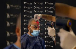 Million Hair Center CEO’ su Fatih Köse: ’’Saç...