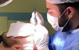 Million Hair Center CEO’su Fatih Köse: “Saç...