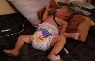 Muhammed bebek ameliyat edildi