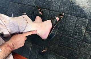 Beykoz’da komşusunu darp ettiği iddia edilen adam...