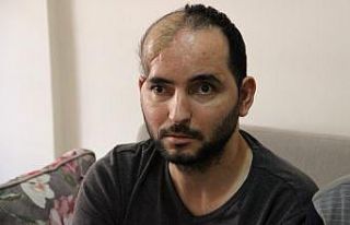 Kahraman Gazi, Türkiye’de ilk kez yapılan yöntemle...