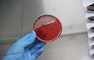 Uzun süre kullanılan maskedeki bakteriler laboratuvarda...