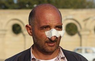 Berde’deki roketli saldırıda yüzünden yaralanan...