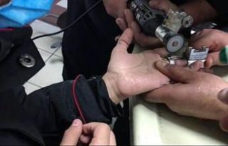 İtfaiyeden yüzük operasyonu; parmağı kangren...