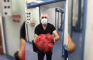 Karın şişliğiyle gittiği hastanede karnından...