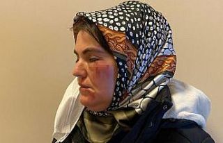 Maltepe’de korkunç olay: Sokak ortasında tanımadığı...
