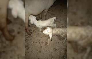 Manisa’da üst dudağı ve burun delikleri olmayan...