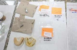 Dokuz Eylül’den diş protezi analizi için yerli...