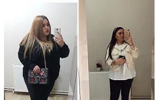 Mide küçültme ameliyatı ile 9 ayda 58 kilo verdi