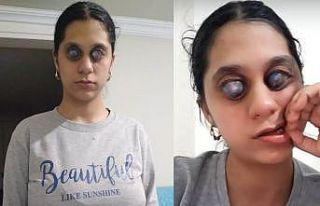 Ümran için Bakanlık harekete geçti