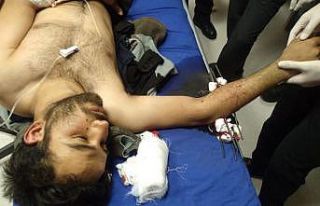 Doktorlar itfaiyeden yardım istedi