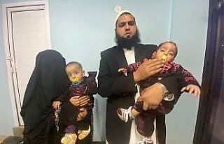 Pakistan’da 9 aylık yapışık ikizler ameliyatla...