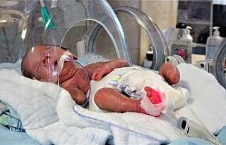 Parmak bebek ayaksız olarak dünyaya geldi
