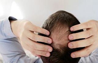 Saçları korona değil stres döküyor