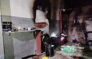 Tinerle sobayı yakmaya çalışınca hastanelik oldu