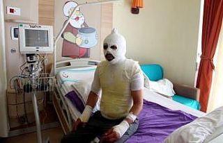 Akrabaları tarafından kaynar suyla yakıldığını...