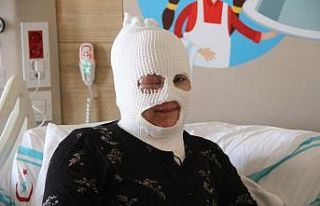 Başından aşağıya çaydanlık dökülen kadın...