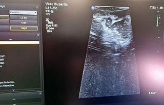 Cumhurbaşkanı Erdoğan’ın açılışını yapmıştı,...