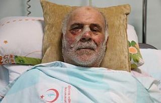 Demir keserken yüzünü parçaladı