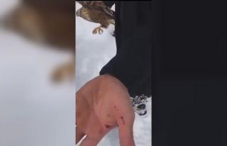 Hayatını kurtardığı şahinin pençeleriyle yaralandı