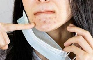 Maske sonrası artan cilt problemlerine önlem de...