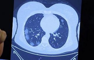 Profesörden korkutan korona açıklaması: "Virüs...