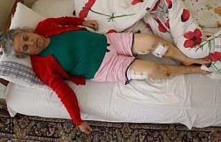 Sokak köpeklerinin saldırısına uğrayan yaşlı...