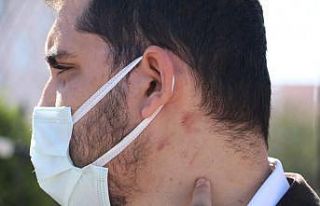 Yüzde 90 engelli adamı öldüresiye darp ettiler