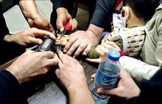 ‘Yüzük’ diye taktığı metal pulu itfaiye çıkarttı