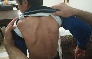 10 yaşındaki çocuğu tırmıkla yaraladı