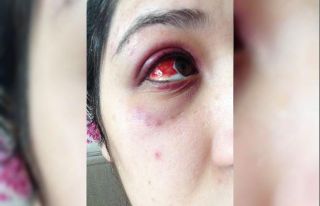 Alkollü avukat genç kızı feci şekilde darp etti