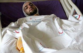 Banyo yapmak için sobaya benzin döktü, feci şekilde...