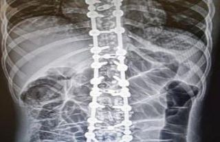 “Osteopati tedavisinde hastalık yoktur, hasta vardır”