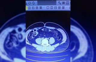 Uçağa binmek isteyen 2 İranlının midesinden 103...