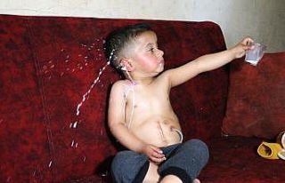 Yemek borusu olmayan Muhammed yardım bekliyor