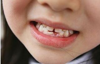 Yer tutucu kullananlar dikkat