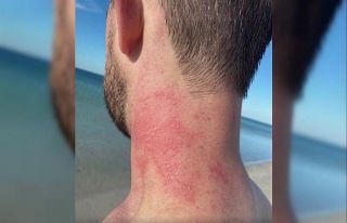 Avustralya’da yer bilimciye ahtapot saldırısı