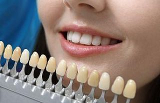 Dişleri beyazlatmada sosyal medya önerileri sağlığınıza...