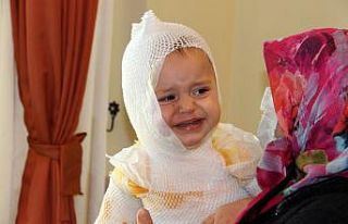 Erzincan’da üzerine kaynar süt dökülen çocuk...