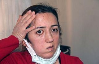 Kafatası kaybolmuştu, şimdi yeni kafatası için...