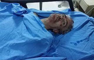 Samsun’daki silahlı saldırıda ölü sayısı...