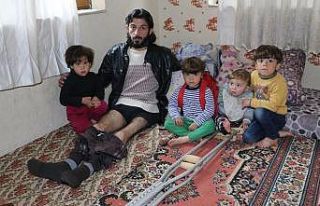 Savaşın izini vücudunda taşıyor