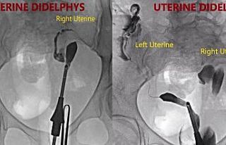 Uzun zaman bebek hasreti çeken anne ve babalar dikkat