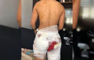 Antalya’da sokak köpeklerinin saldırısına uğrayan...