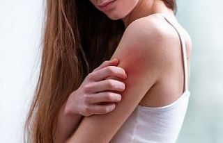 Baharda sık görülen 5 cilt hastalığı