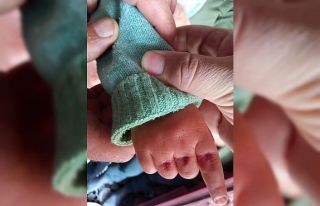 Eli kapı arasında sıkışan minik kızı itfaiye...