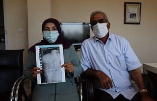 Karnında unutulan makasla 2 ay dolaştı