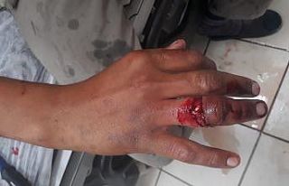 Parmağı yüzüğüne sıkışan şahsı itfaiye...