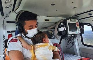 Yanan bebeği helikopter ambulansta hastaneye kadar...