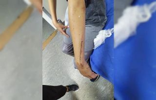 Yüzü ve kollarında kesikler oluşan çocuğa 70...